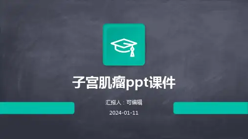 子宫肌瘤ppt课件