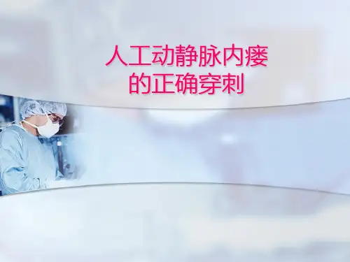 人工动静脉内瘘的正确穿刺