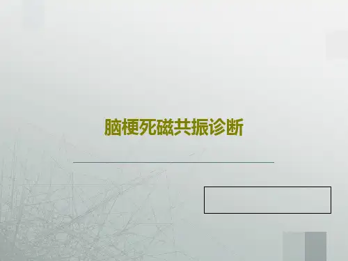 脑梗死磁共振诊断53页PPT