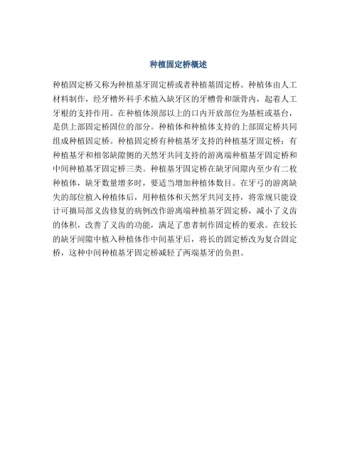 种植固定桥概述