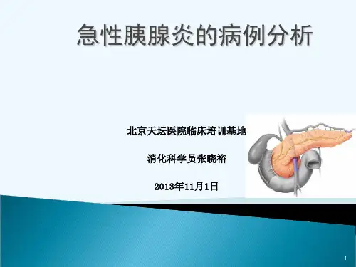 急性胰腺炎的病例分析终稿