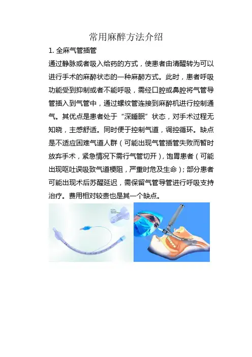 常用麻醉方法介绍