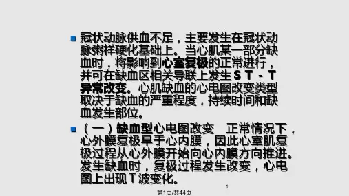 n心肌缺血与心梗PPT课件