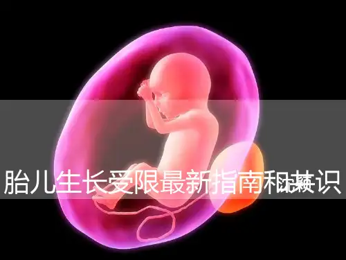 胎儿生长受限最新指南和共识 ppt课件