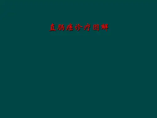 直肠癌诊疗图解