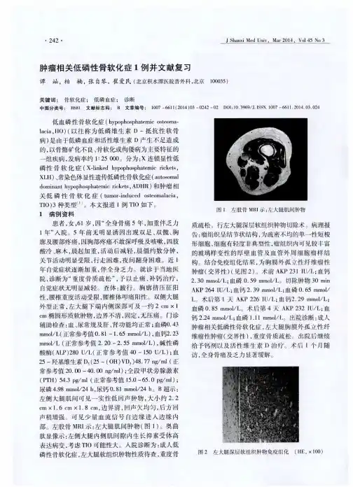 肿瘤相关低磷性骨软化症1例并文献复习