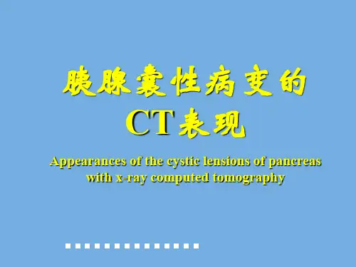 胰腺性病变的CT表现