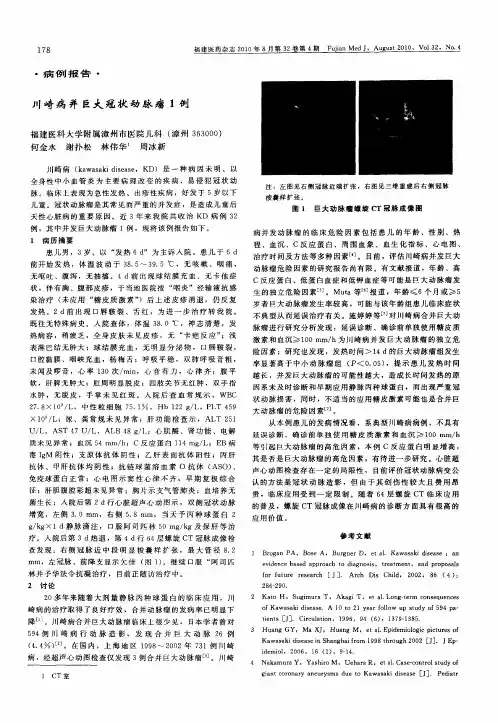 川崎病并巨大冠状动脉瘤1例