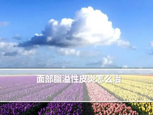 面部脂溢性皮炎怎么治
