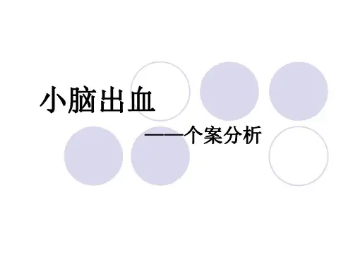 小脑出血——个案分析