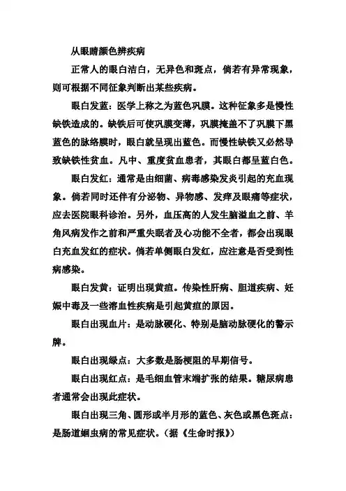 从眼睛颜色辨疾病