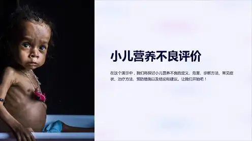 小儿营养不良评价