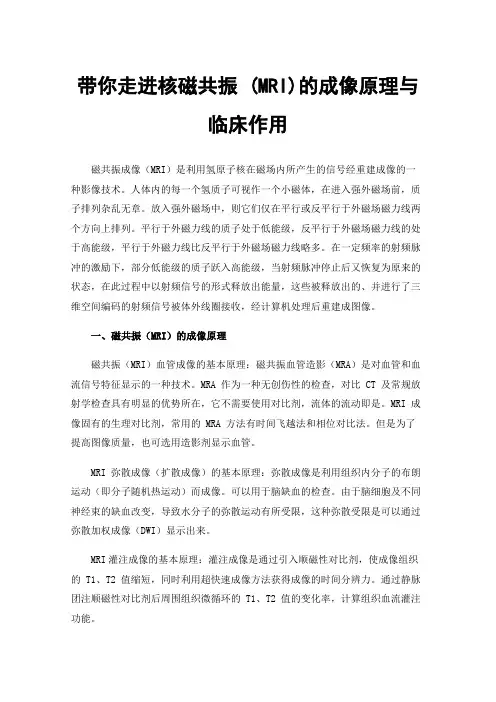 带你走进核磁共振(MRI)的成像原理与临床作用