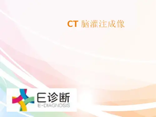 医学影像-CT脑灌注成像