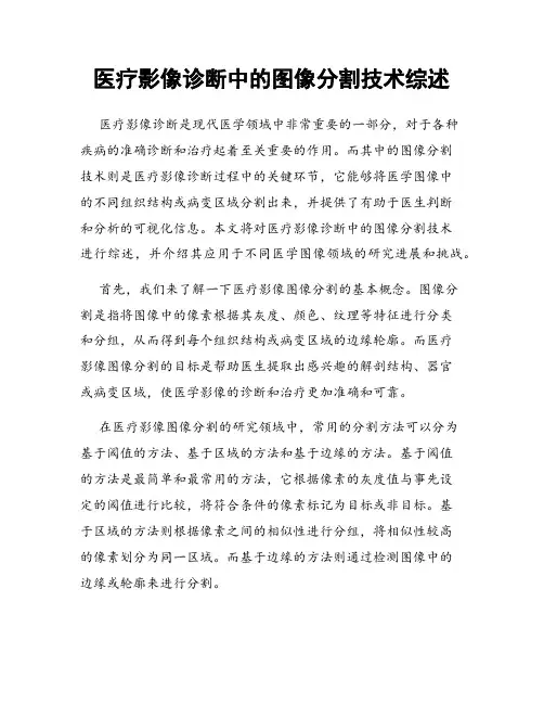 医疗影像诊断中的图像分割技术综述