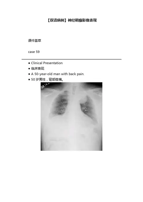 【双语病例】神经鞘瘤影像表现