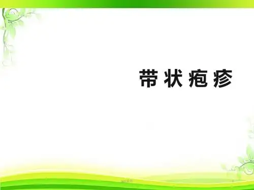 带状疱疹  ppt课件