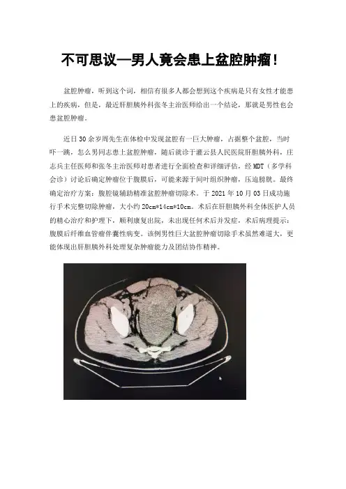 不可思议—男人竟会患上盆腔肿瘤！