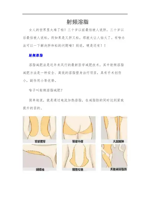 射频溶脂