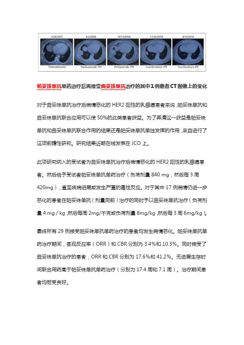帕妥珠单抗和曲妥珠单抗——合则利,分则伤