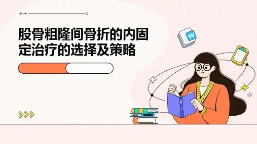 股骨粗隆间骨折的内固定治疗的选择及策略