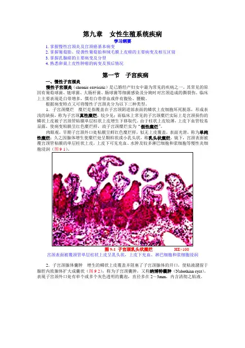 女性生殖系统疾病