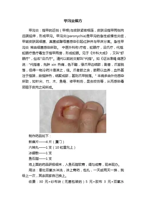 甲沟炎偏方