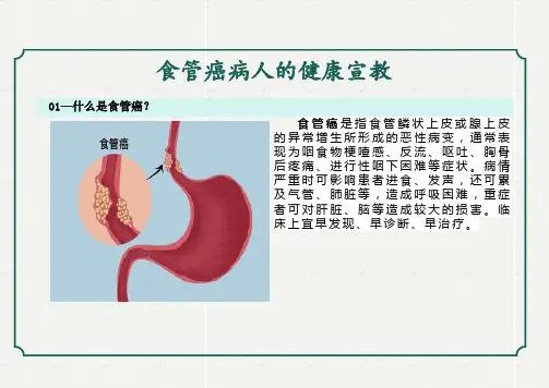 食管癌的健康宣教