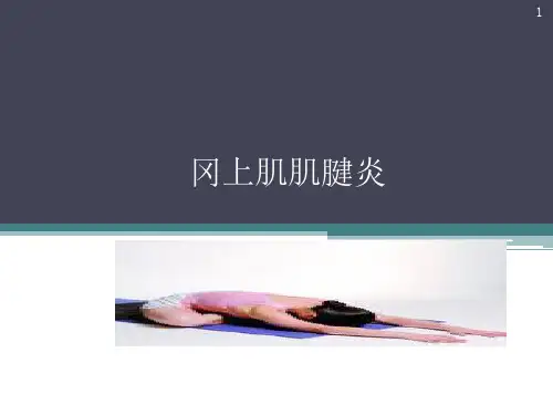 冈上肌炎PPT课件