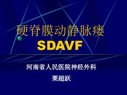 硬脊膜动静脉瘘 栗超跃