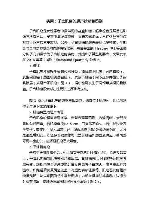 实用：子宫肌瘤的超声诊断和鉴别