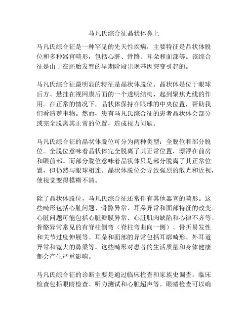 马凡氏综合征晶状体鼻上