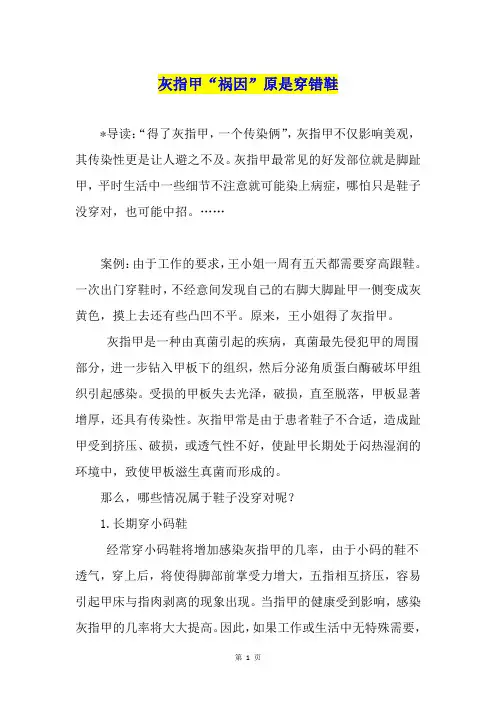 灰指甲“祸因”原是穿错鞋