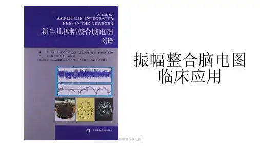 振幅整合脑电图