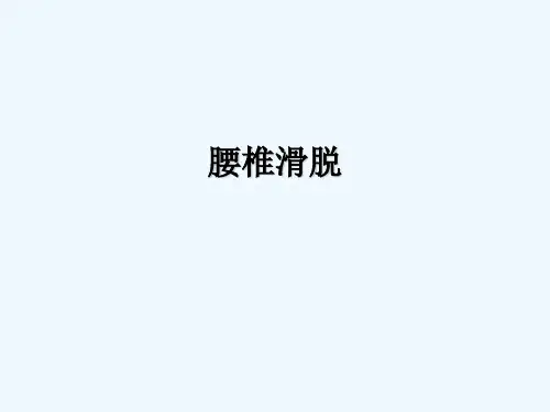 腰椎滑脱课件 PPT