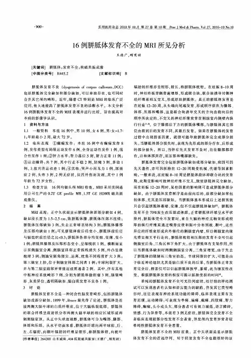 16例胼胝体发育不全的MRI所见分析