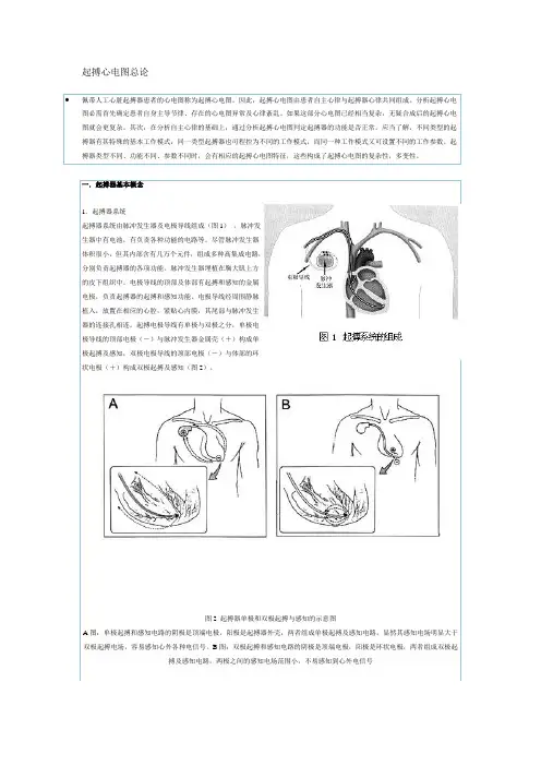 起搏心电图总论