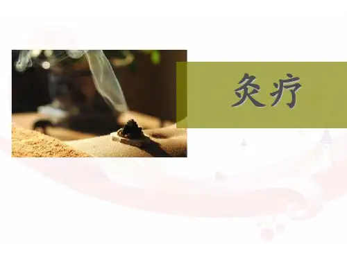 艾灸  ppt课件