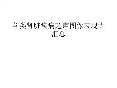 各类肾脏疾病超声图像表现大汇总