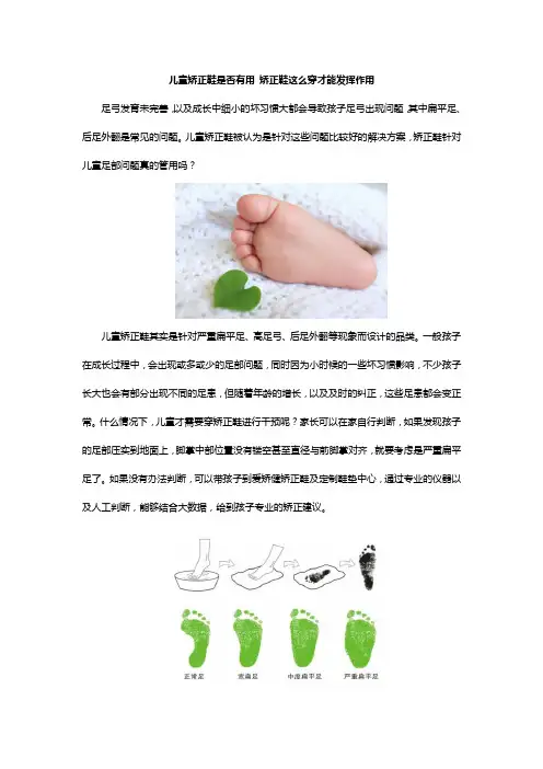 儿童矫正鞋有用吗？矫正鞋这么穿才能发挥作用