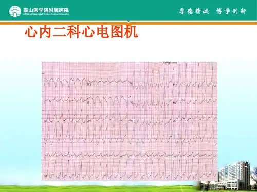 心内科常用检查及注意事项培训课件