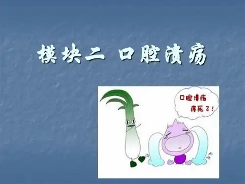 口腔溃疡PPT课件
