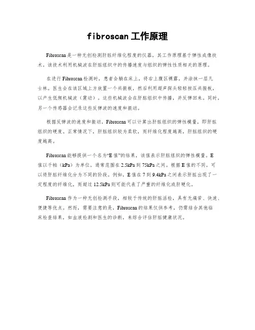 fibroscan工作原理