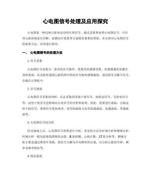 心电图信号处理及应用探究
