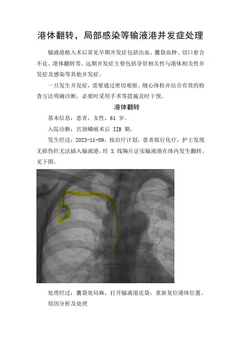 港体翻转,局部感染等输液港并发症处理
