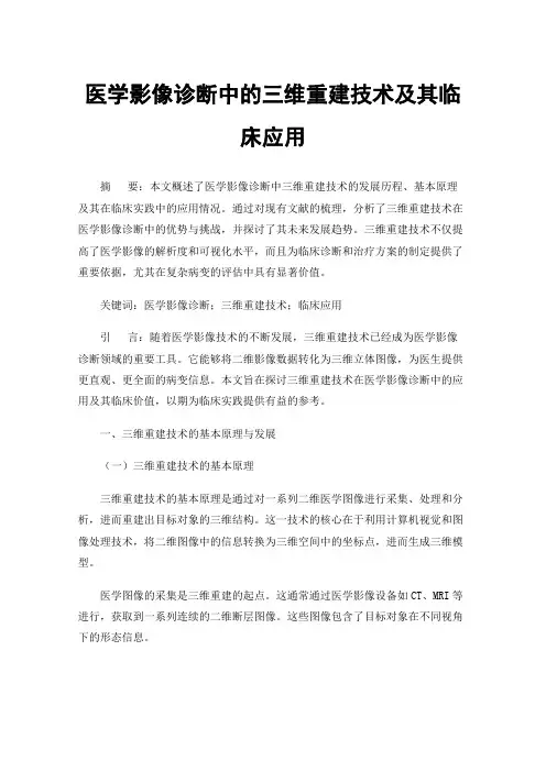 医学影像诊断中的三维重建技术及其临床应用