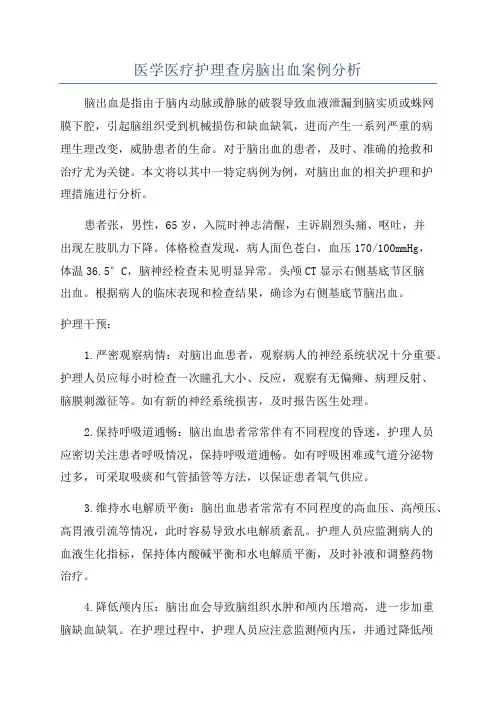 医学医疗护理查房脑出血案例分析