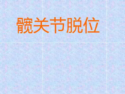 髋关节脱位PPT课件