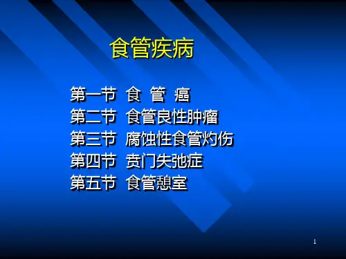 食道癌胸外科ppt课件