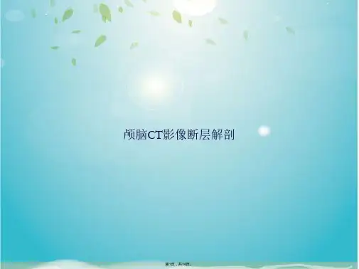 颅脑CT影像断层解剖(共14张PPT)
